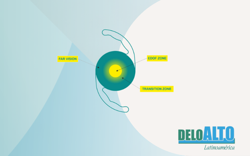 Lente intraocular plegable de una sola pieza y cámara posterior de acrílico hidrofóbico, Biconvexo - Borde cuadrado de 360° con óptica refractiva 6mm, A-Constante: 118.00 y Óptica A-Constante:  A-SRK/T : 119,20 | SRK/II: 119,50 longitud total: 13.00mm, (Adicción intermedia +2,00D) EDOF602SQ Freedom 